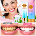 Oralhoe - Nicotinamide Dazzle White Toothpaste