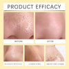Eelhoe- Nose Plants Pore Strips