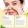 Eelhoe- Nose Plants Pore Strips