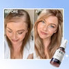 FEG Plus Hair Growth Spray